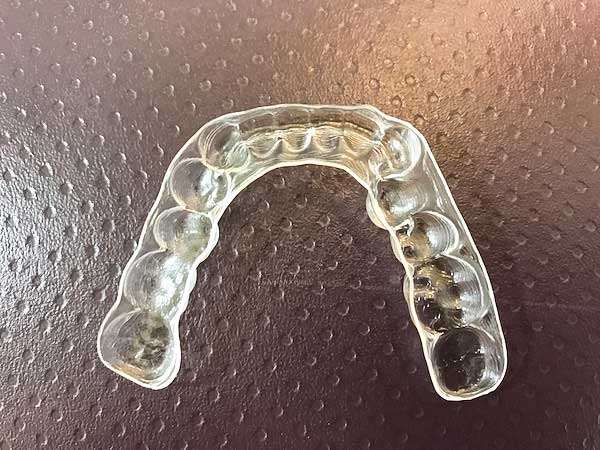 マウスピース矯正イメージ