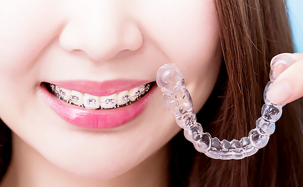 お口の発育をサポートイメージ