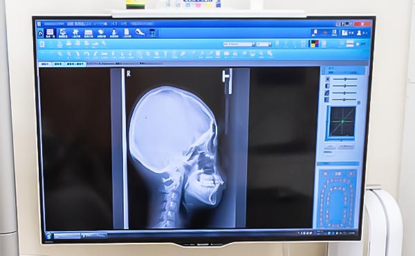 デジタルレントゲンイメージ