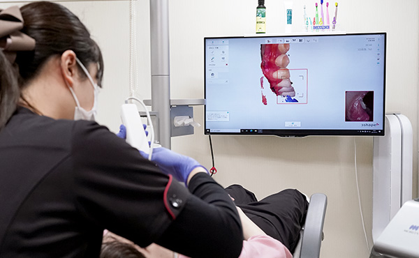 口腔内スキャン TRIOS3イメージ