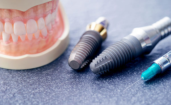 歯を作るイメージ