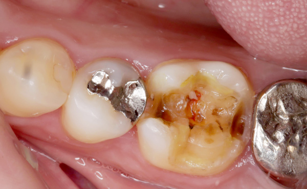 セラミクスイメージ