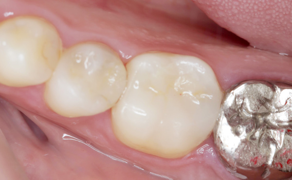 セラミクスイメージ