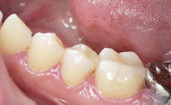 セラミクスイメージ