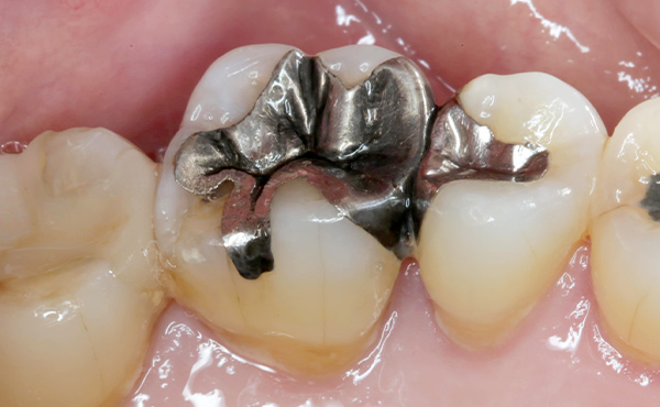 セラミクスイメージ