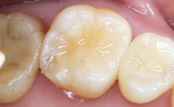 セラミクスイメージ