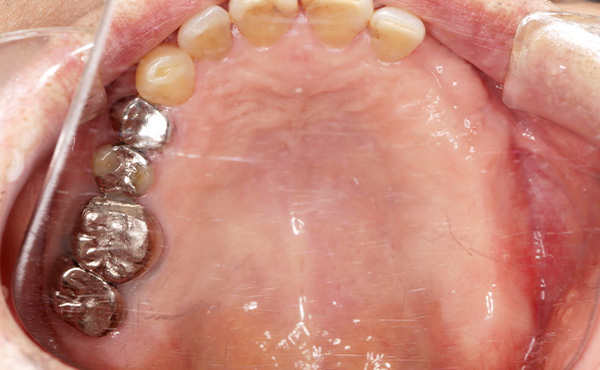 セラミクスイメージ