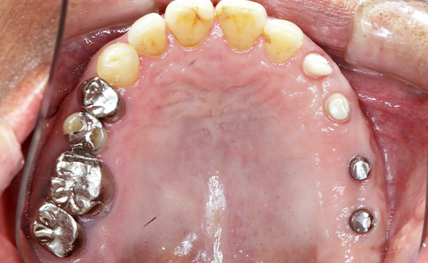 セラミクスイメージ