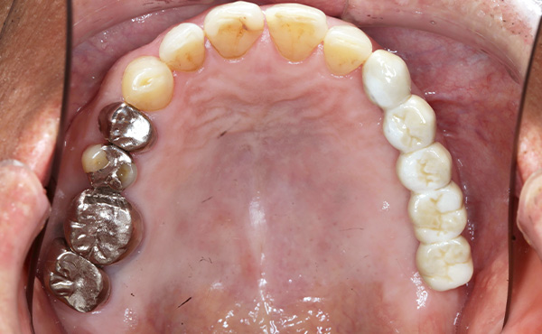 セラミクスイメージ