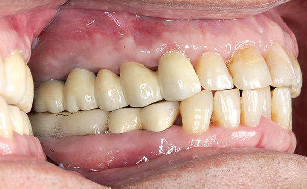 セラミクスイメージ